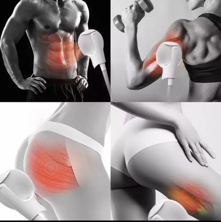 Emshape Muskelnaufbau und Körperformen 